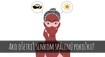 Ako ošetriť slnkom spálenú pokožku?
