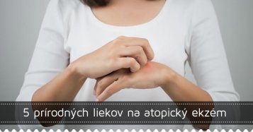 5 prírodných liekov na atopický ekzém