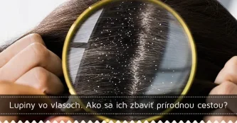 Lupiny vo vlasoch. Ako sa ich zbaviť prírodnou cestou?