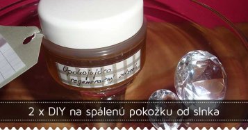 2 x DIY pre spálenú pokožku od slnka