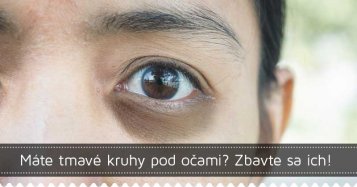 Máte tmavé kruhy pod očami? Zbavte sa ich!