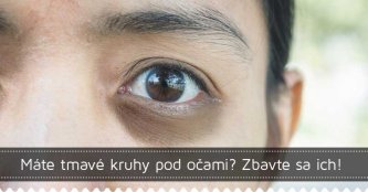 Máte tmavé kruhy pod očami? Zbavte sa ich!