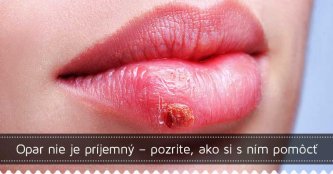 Opar nie je príjemný – pozrite, ako si s ním pomôcť Opar nie je príjemný – pozrite, ako si s ním pomôcť