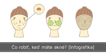 Čo robiť, keď máte akné?
