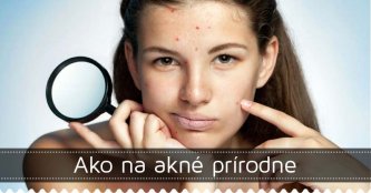 Ako na akné prírodne Ako na akné prírodne