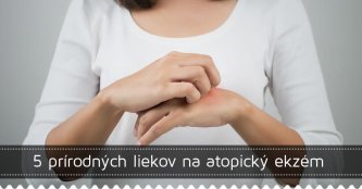 5 prírodných liekov na atopický ekzém 5 prírodných liekov na atopický ekzém
