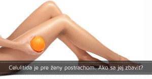 Celulitída je pre ženy postrachom. Ako sa jej zbaviť? Celulitída je pre ženy postrachom. Ako sa jej zbaviť?