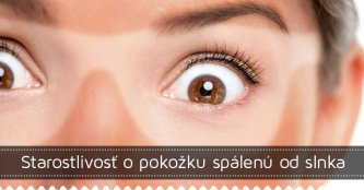 Starostlivosť o pokožku spálenú od slnka Starostlivosť o pokožku spálenú od slnka