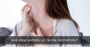 Aké oleje pomôžu pri liečbe dermatitídy? Aké oleje pomôžu pri liečbe dermatitídy?