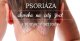 Psoriáza – choroba na celý život a pomoc z prírody