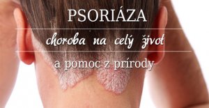 Psoriáza – choroba na celý život a pomoc z prírody